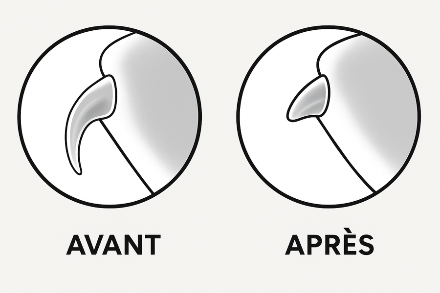 PattesDouces™ — Lime à ongles électrique